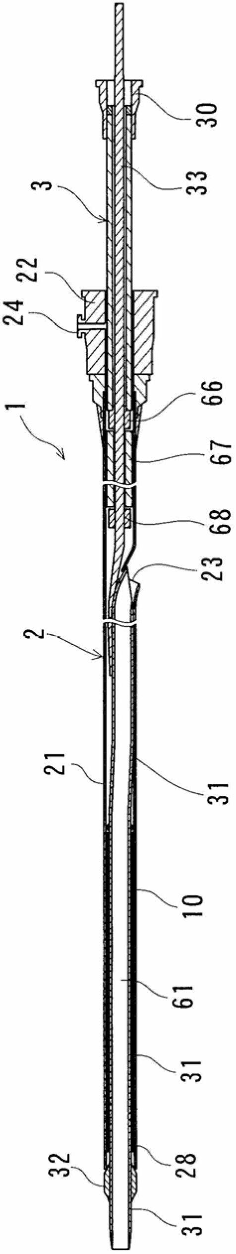 Stent delivery system