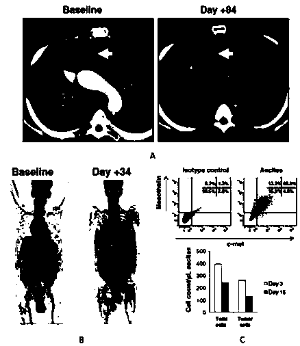 A replication-defective recombinant lentiviral car-t transgene vector targeting mesothelin and its construction method and application