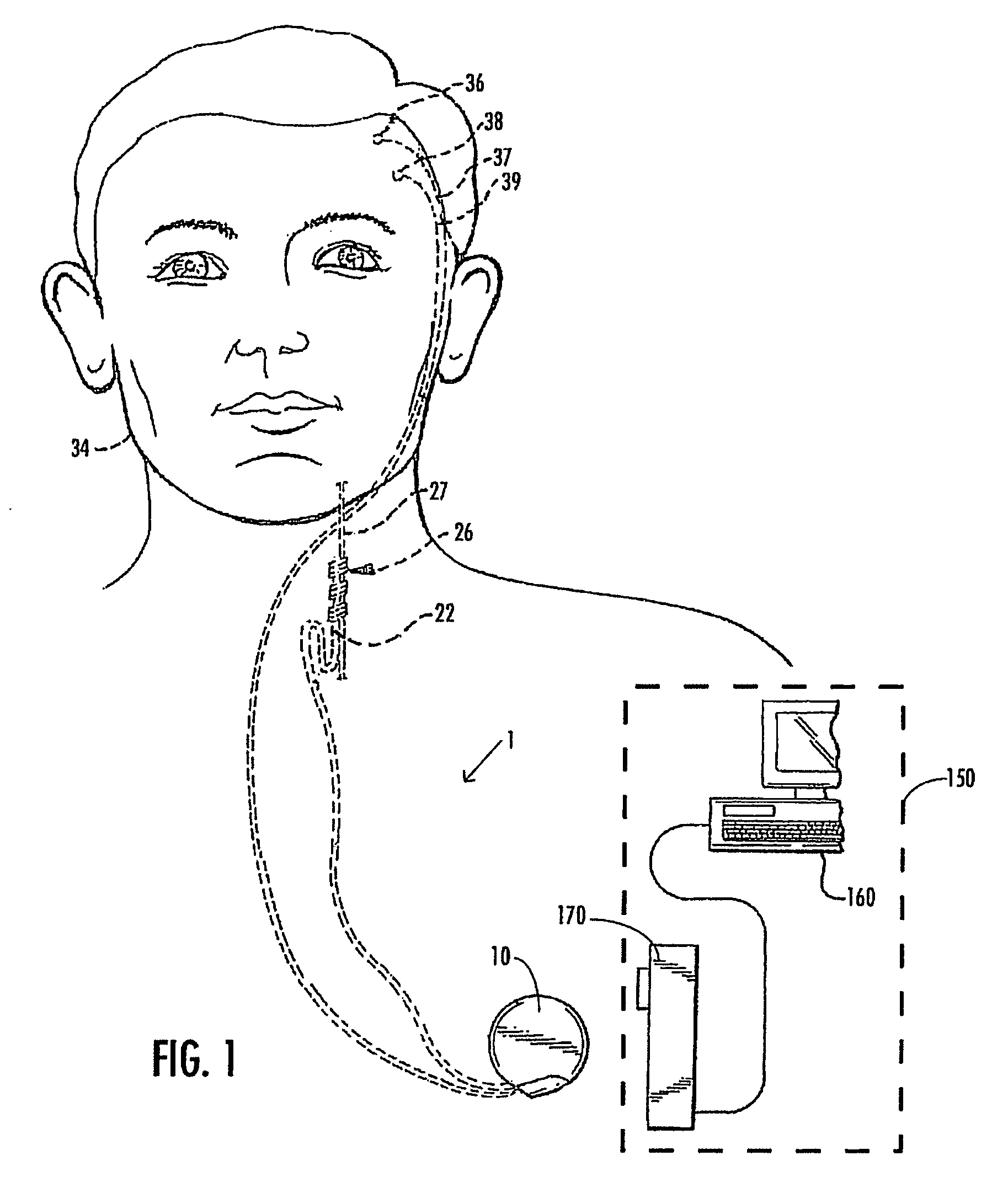 Selective neurostimulation for treating epilepsy