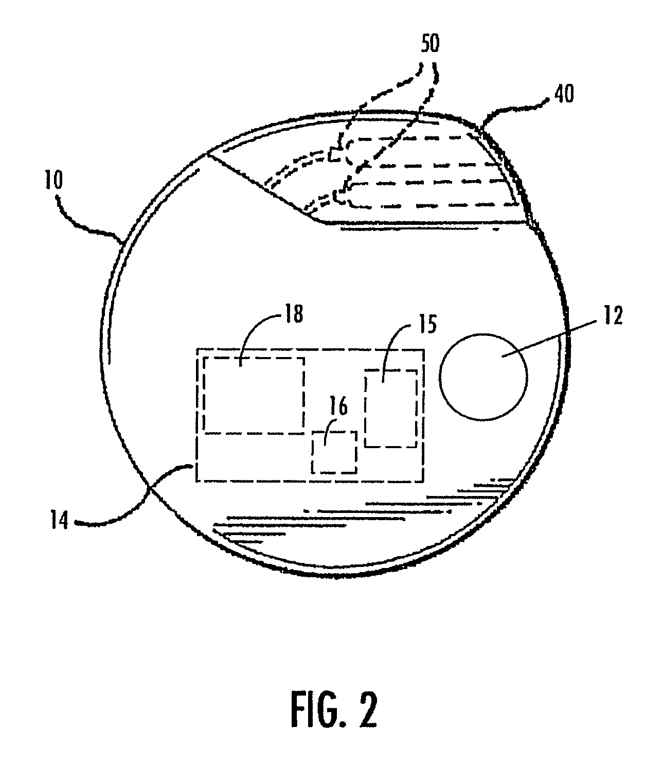 Selective neurostimulation for treating epilepsy