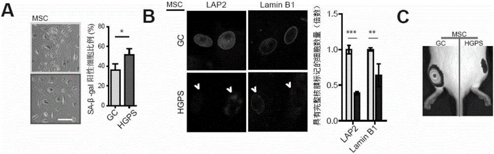 Application of oltipraz in reversal of senescence-like phenotype of Hutchinson-Gilford progeria syndrome