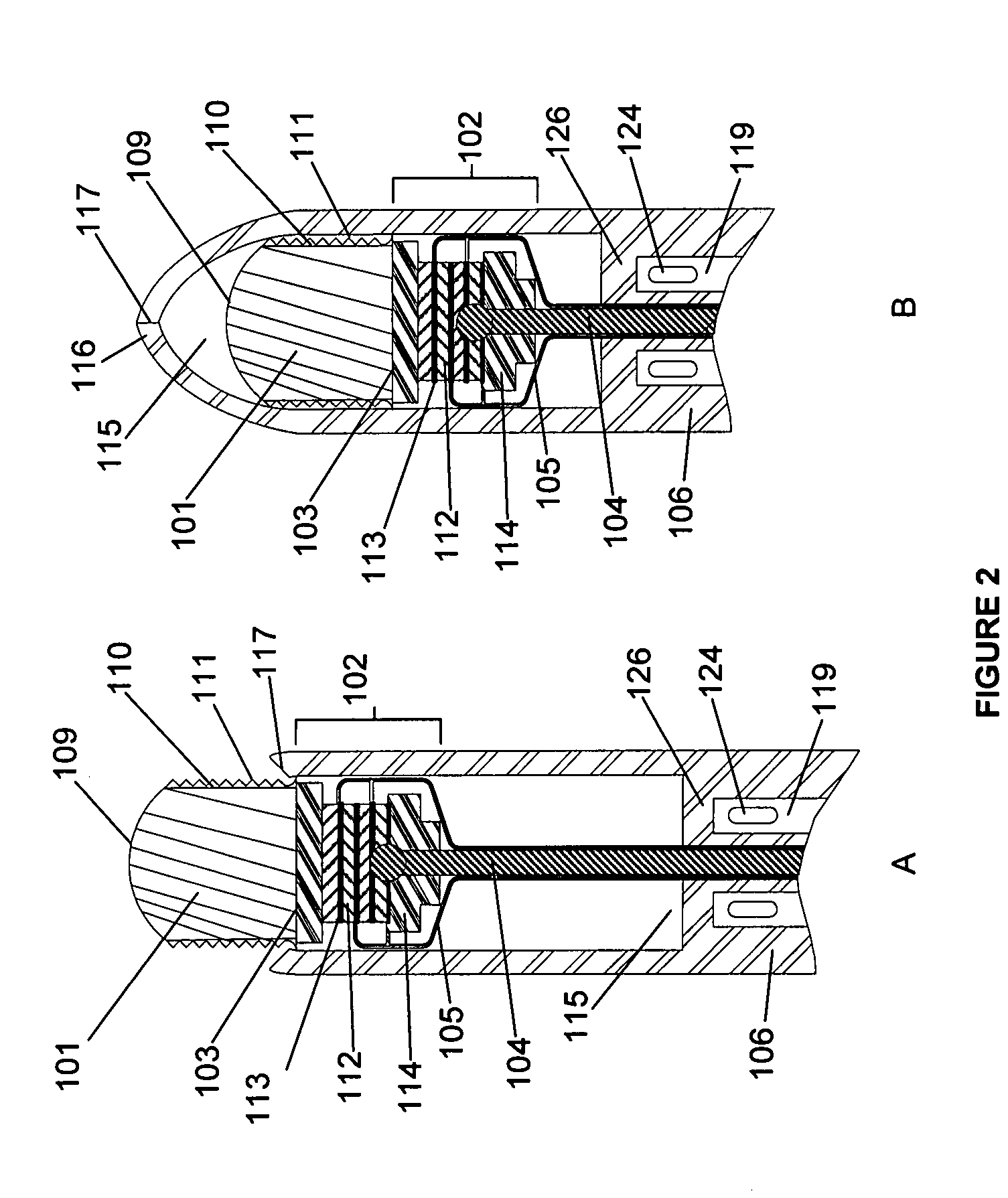 Ablative ultrasonic-cryogenic apparatus