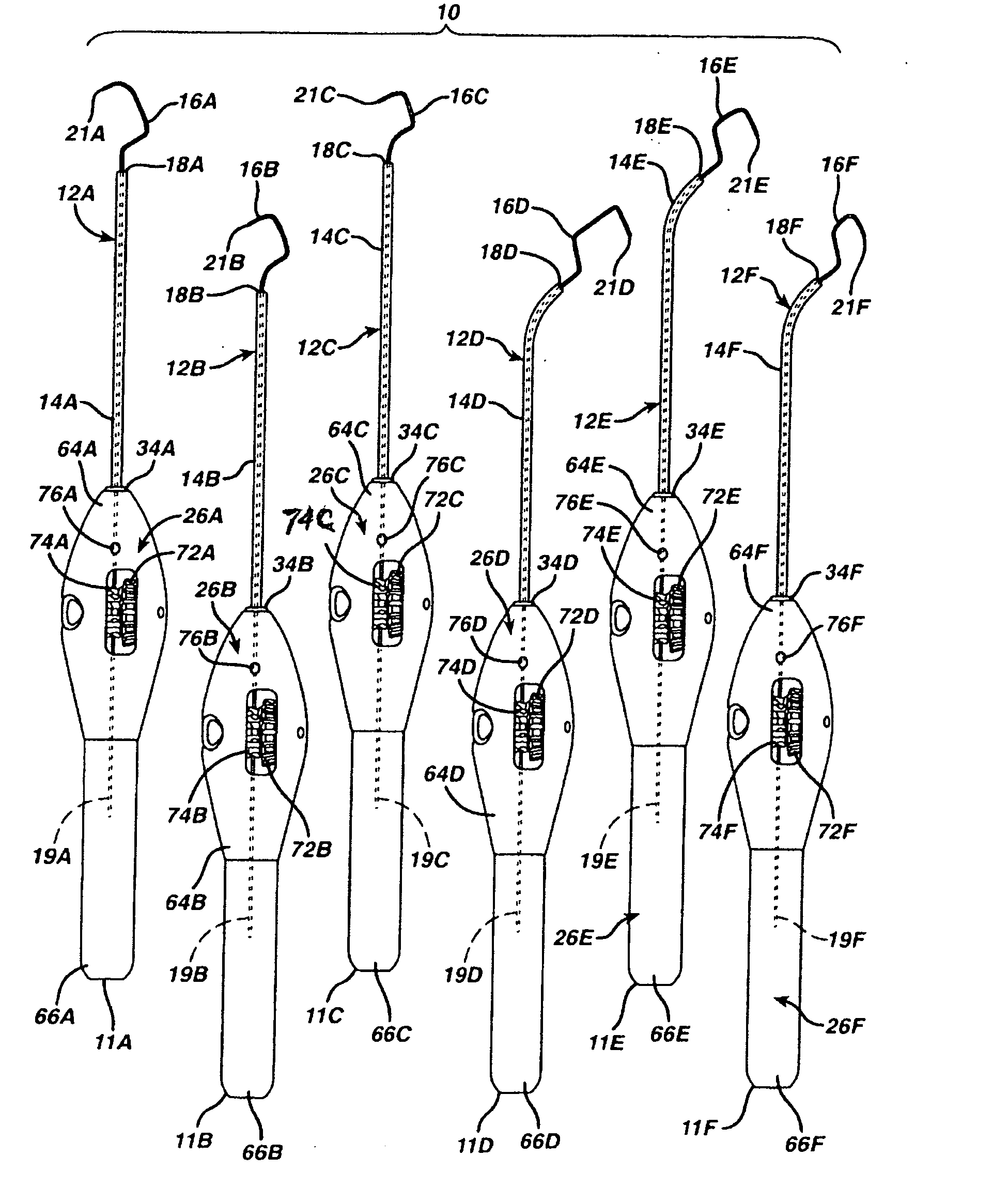 Implant system with sizing templates