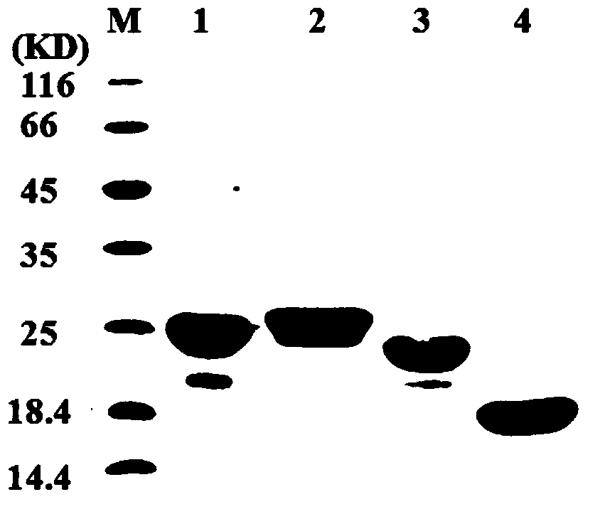 A tumor necrosis factor-related apoptosis-inducing ligand variant and its preparation method and use