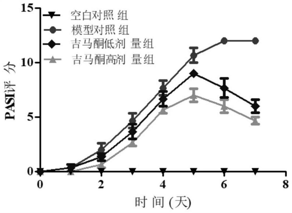 Application of gemmaconone in the preparation of medicines for preventing and treating psoriasis