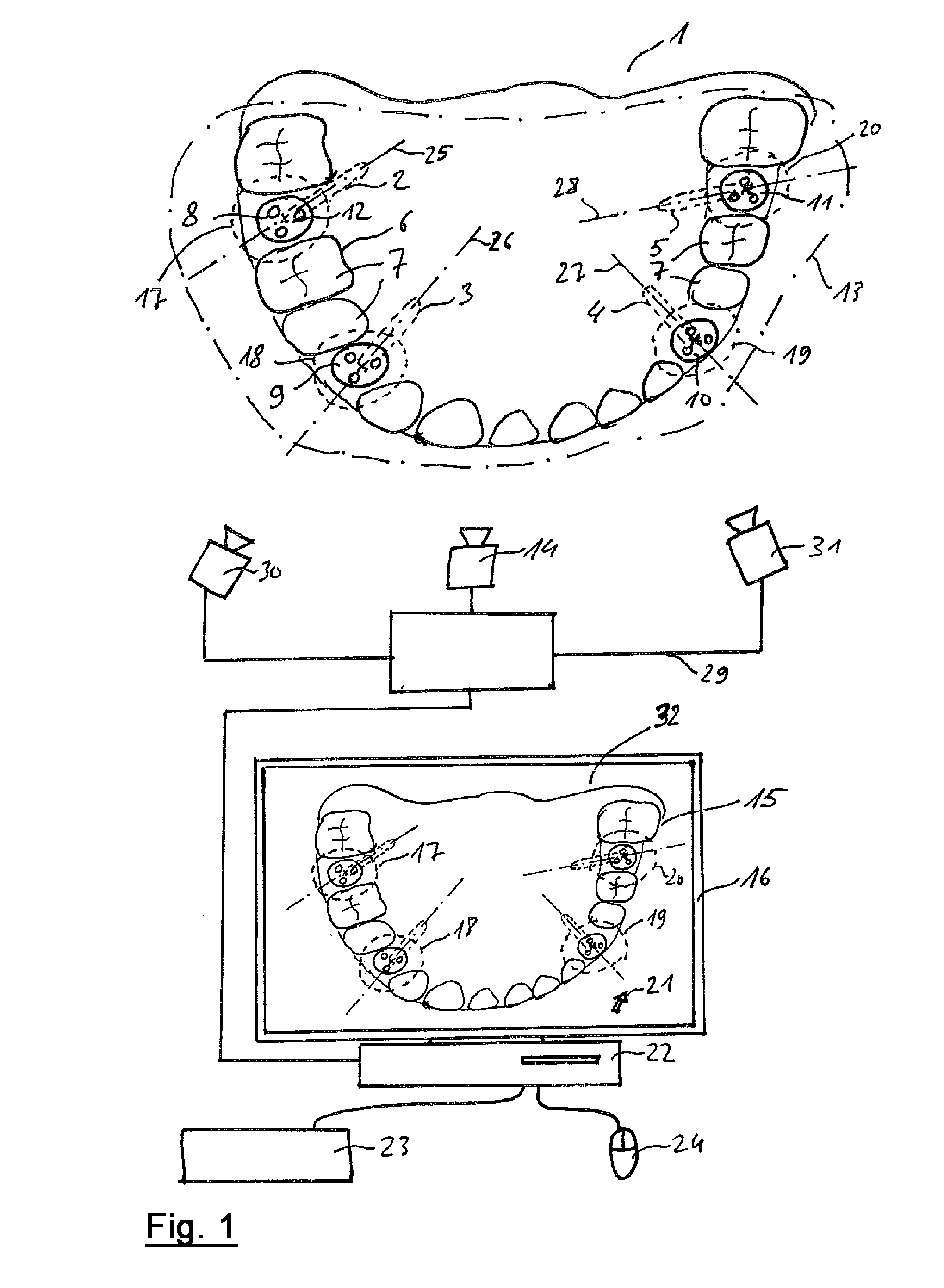 Method for measuring a dental situation