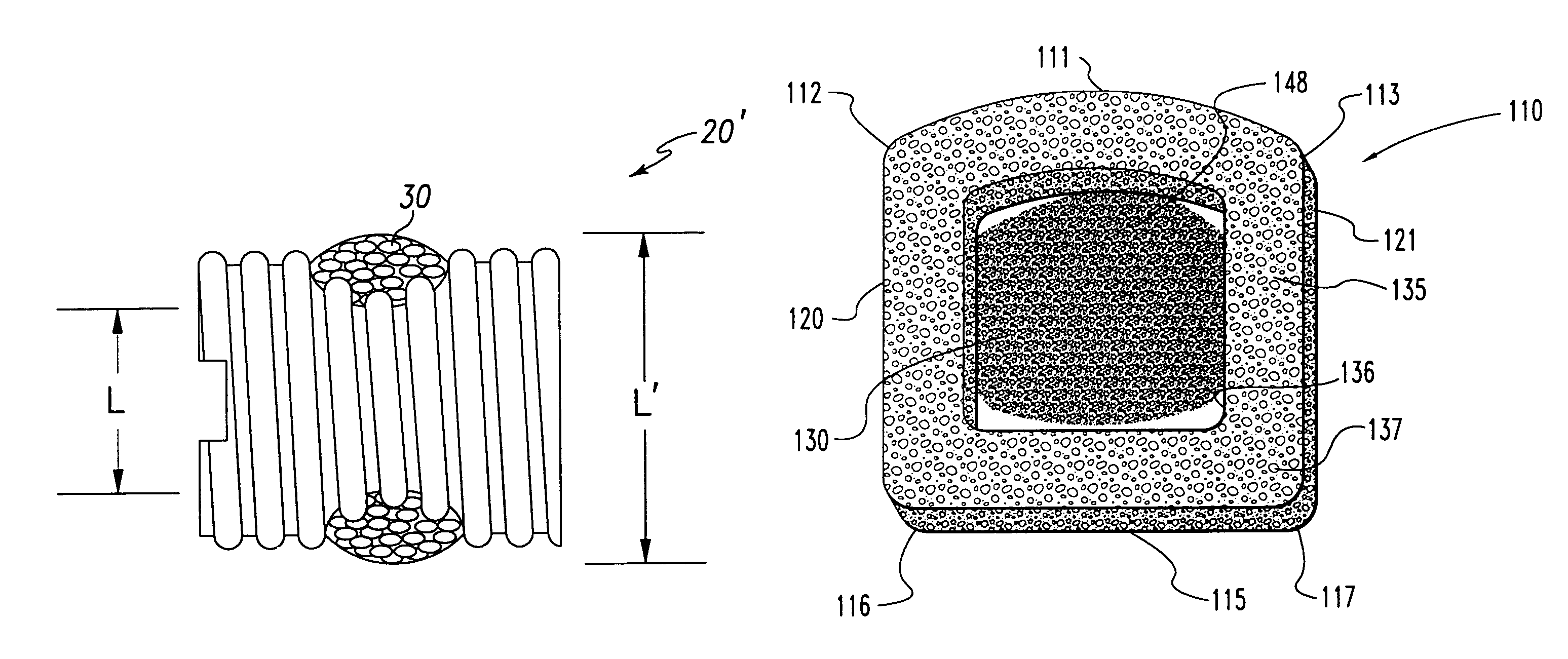 Bone grafts