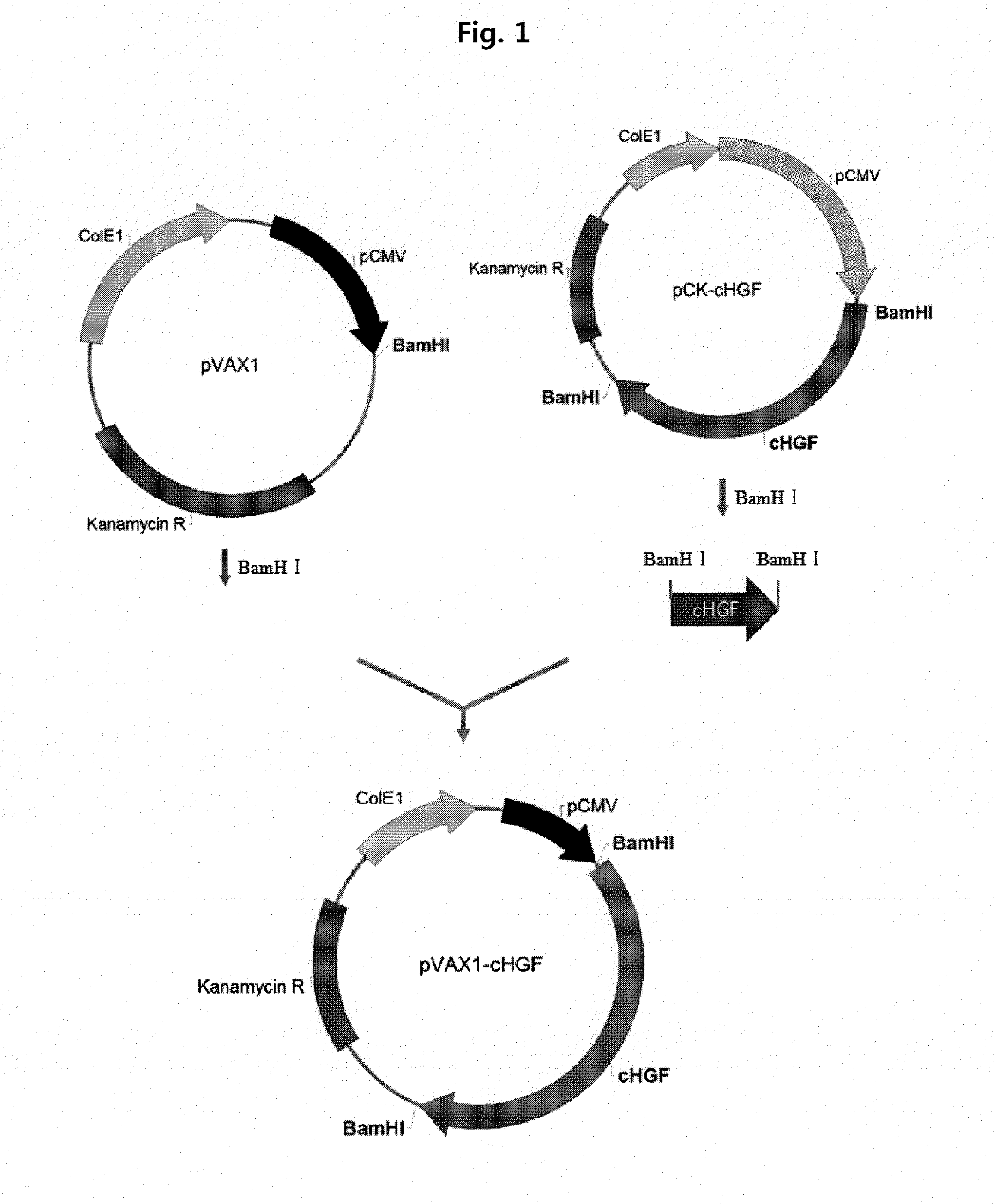 Gene therapy for diabetic neuropathy using an hgf isoform