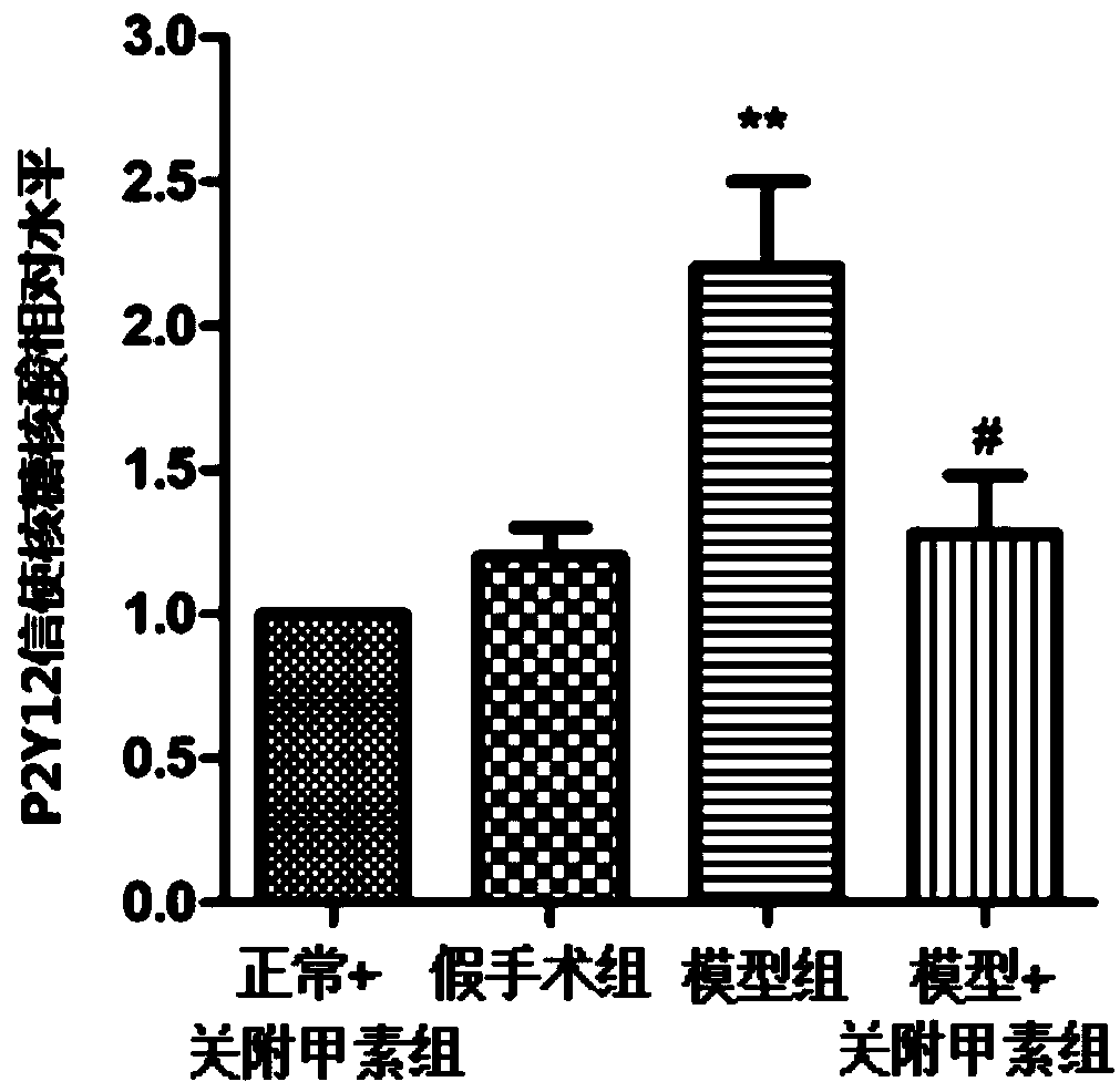 Application of GFA (Guanfu base A) in preparation of drug for neuropathic pain