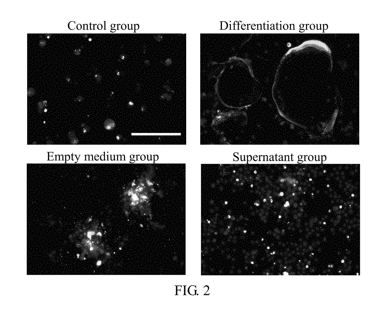 Method for preventing and/or treating osteoporosis by using <i>Streptococcus thermophilus </i>TC1633 strain and its metabolites