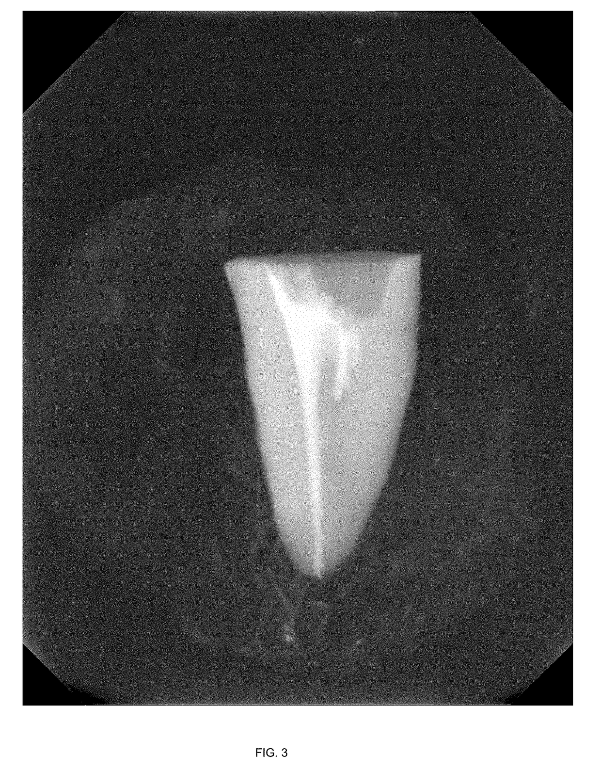 Biomimetic mineral based endodontic cement composition and uses thereof