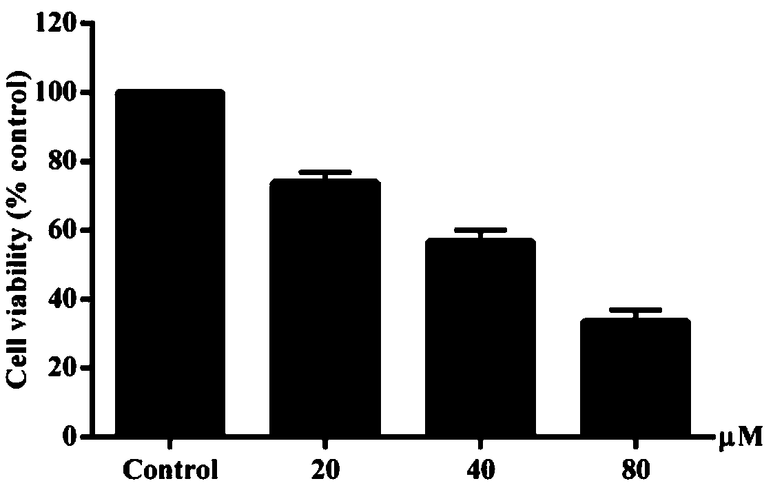 Liver cancer resistant health care product containing costunolide