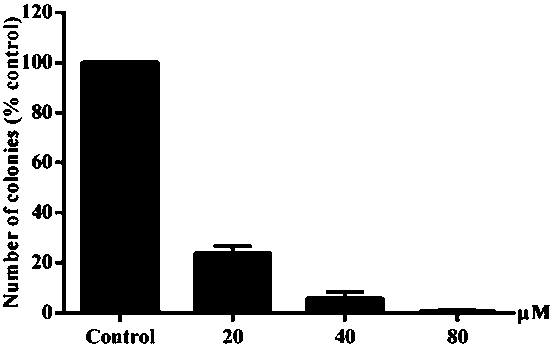 Liver cancer resistant health care product containing costunolide