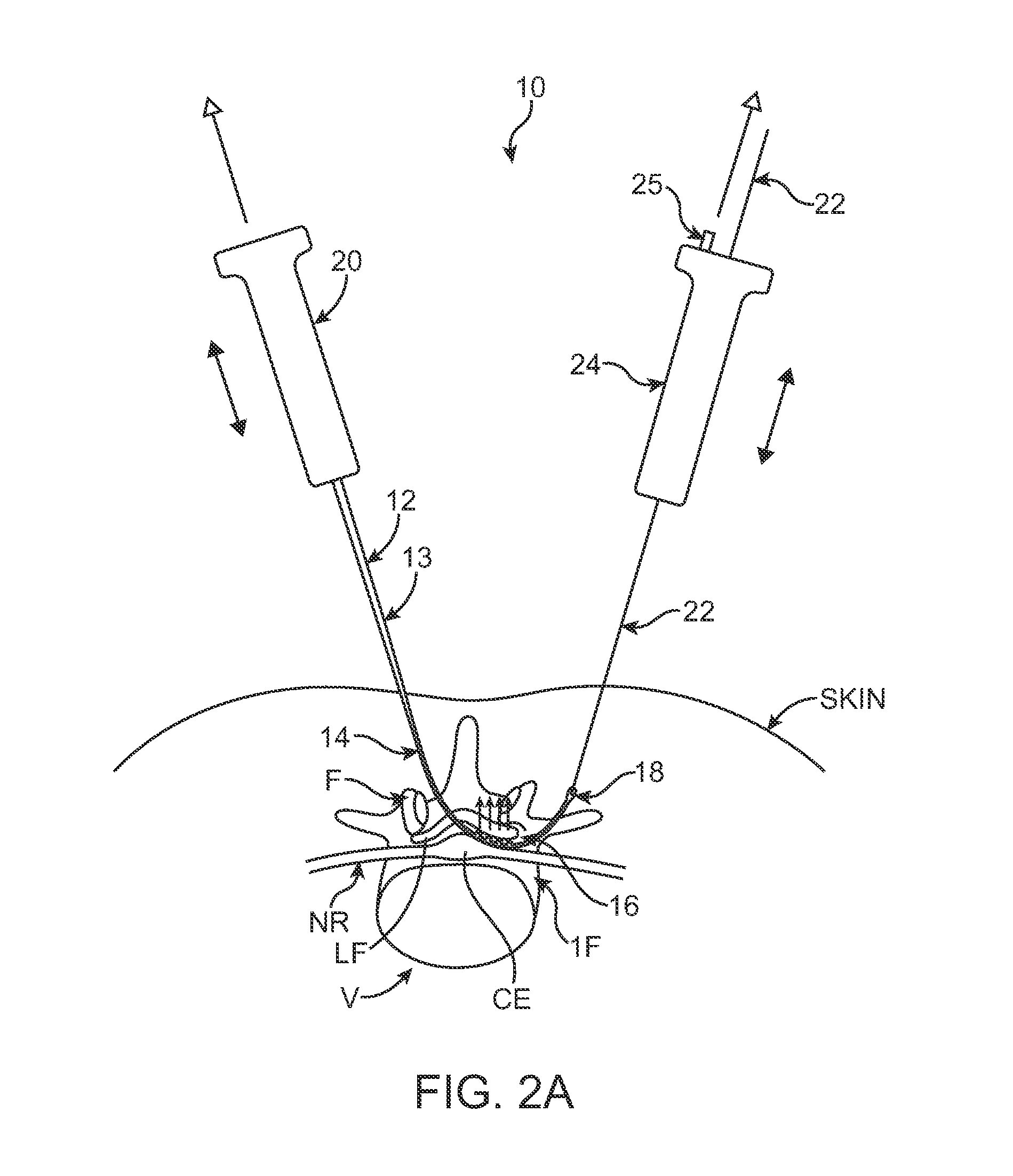 Methods, systems and devices for carpal tunnel release