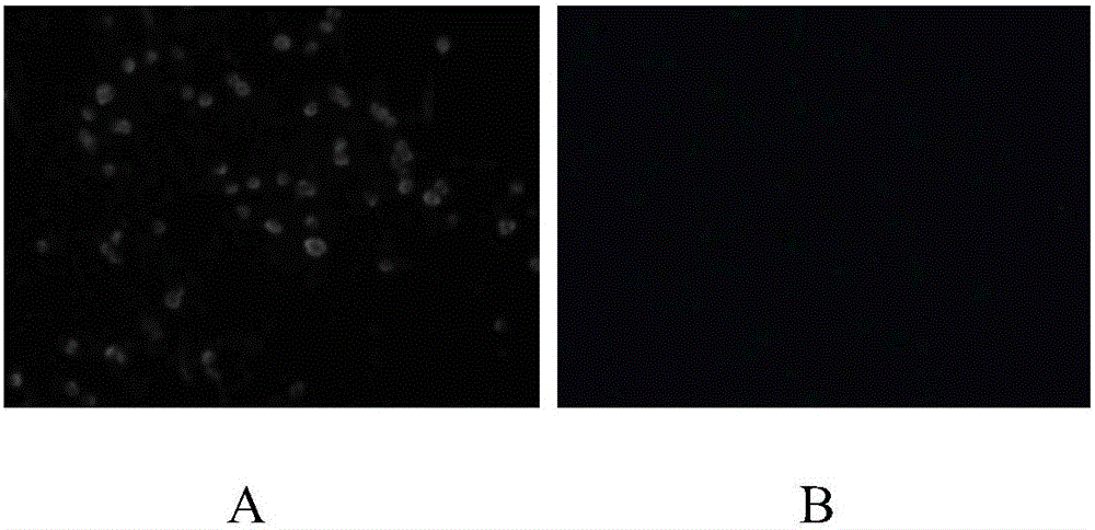 Porcine circovirus type 2 strain, inactivated vaccine prepared from porcine circovirus type 2 strain and application of porcine circovirus type 2 strain