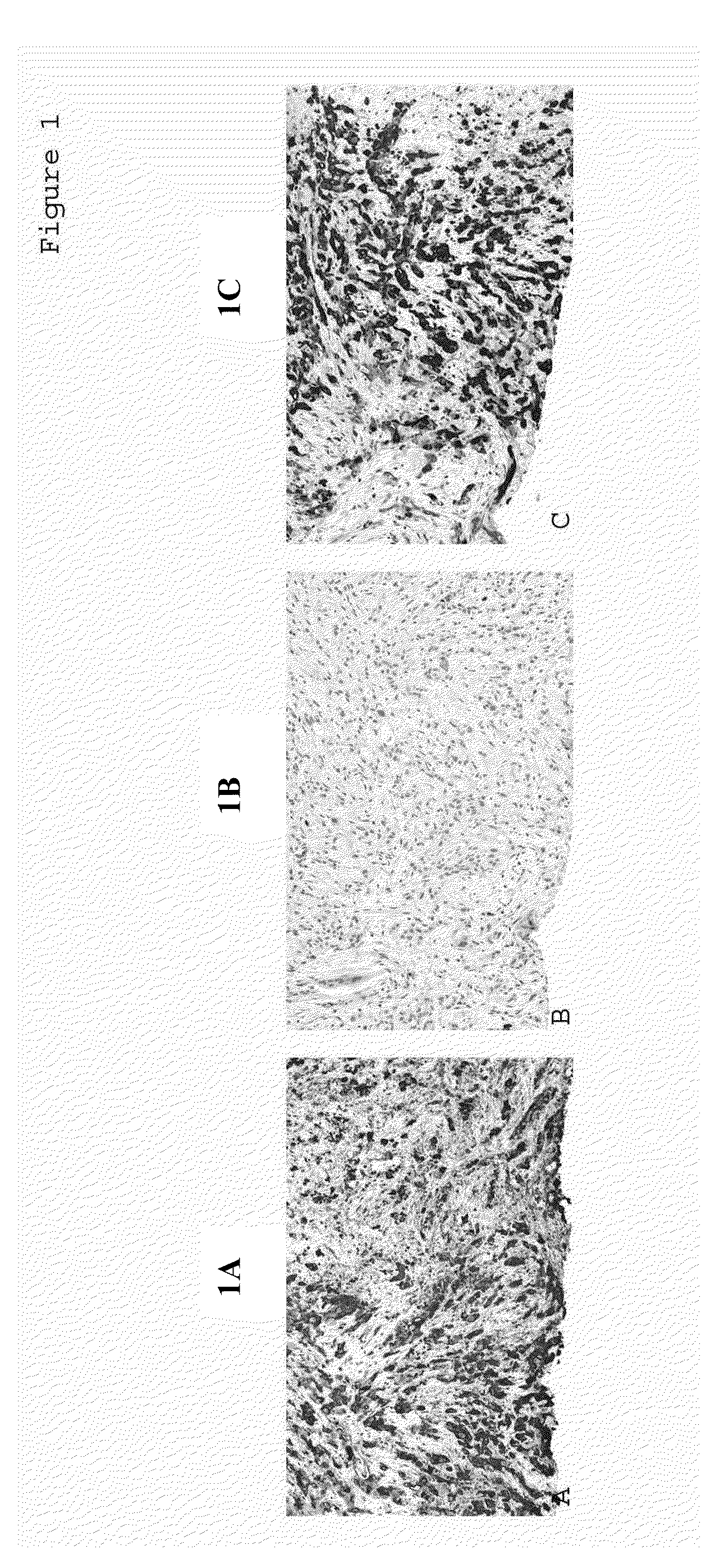 Methods for Detecting Tumor Origin Based on MUC1, MUC2, and CK-17 Expression Levels