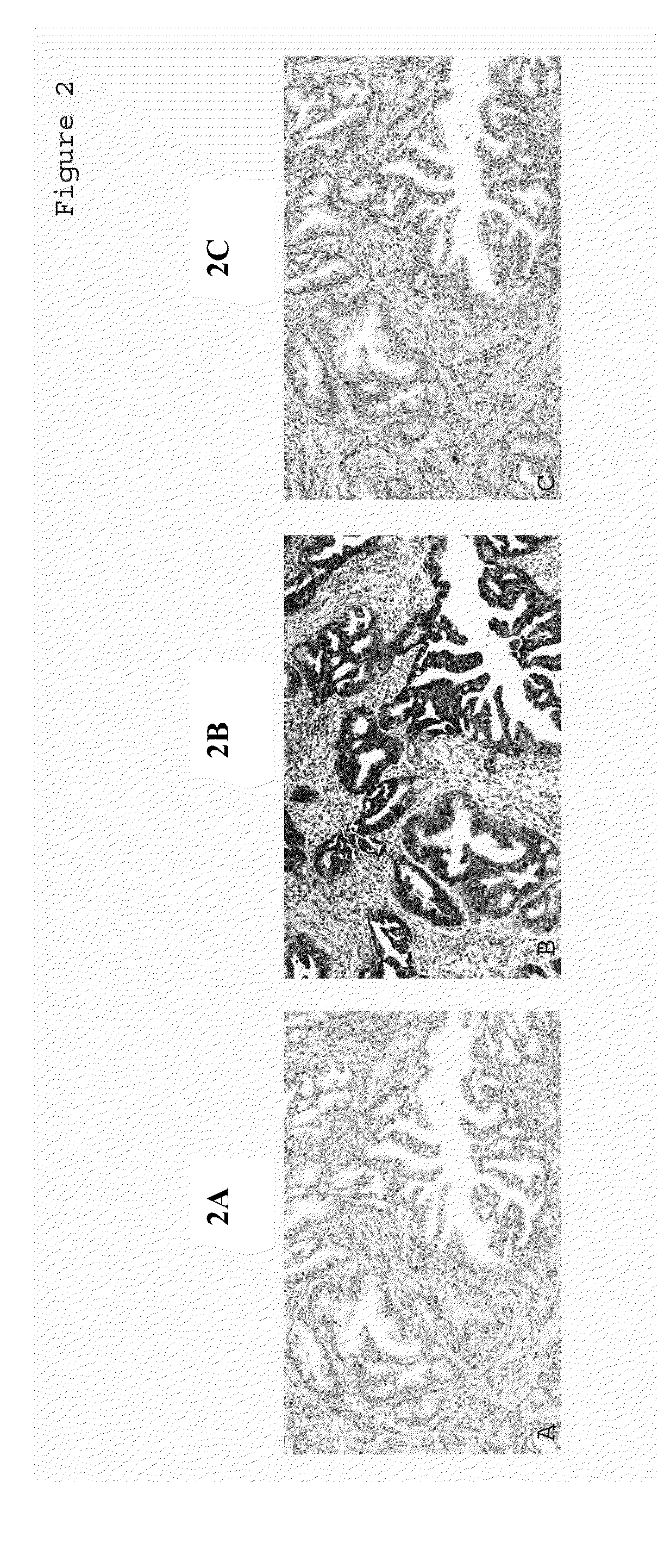 Methods for Detecting Tumor Origin Based on MUC1, MUC2, and CK-17 Expression Levels