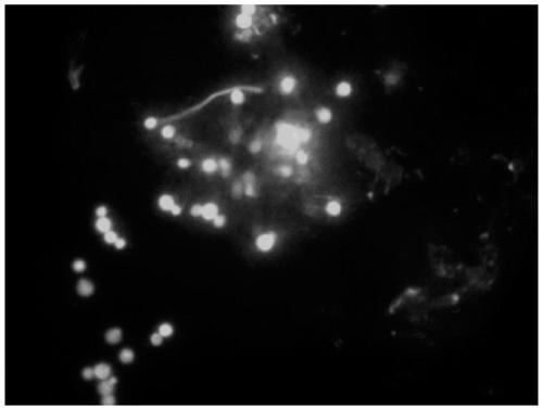 Application of basic chitinase from vibrio in fungus dyeing