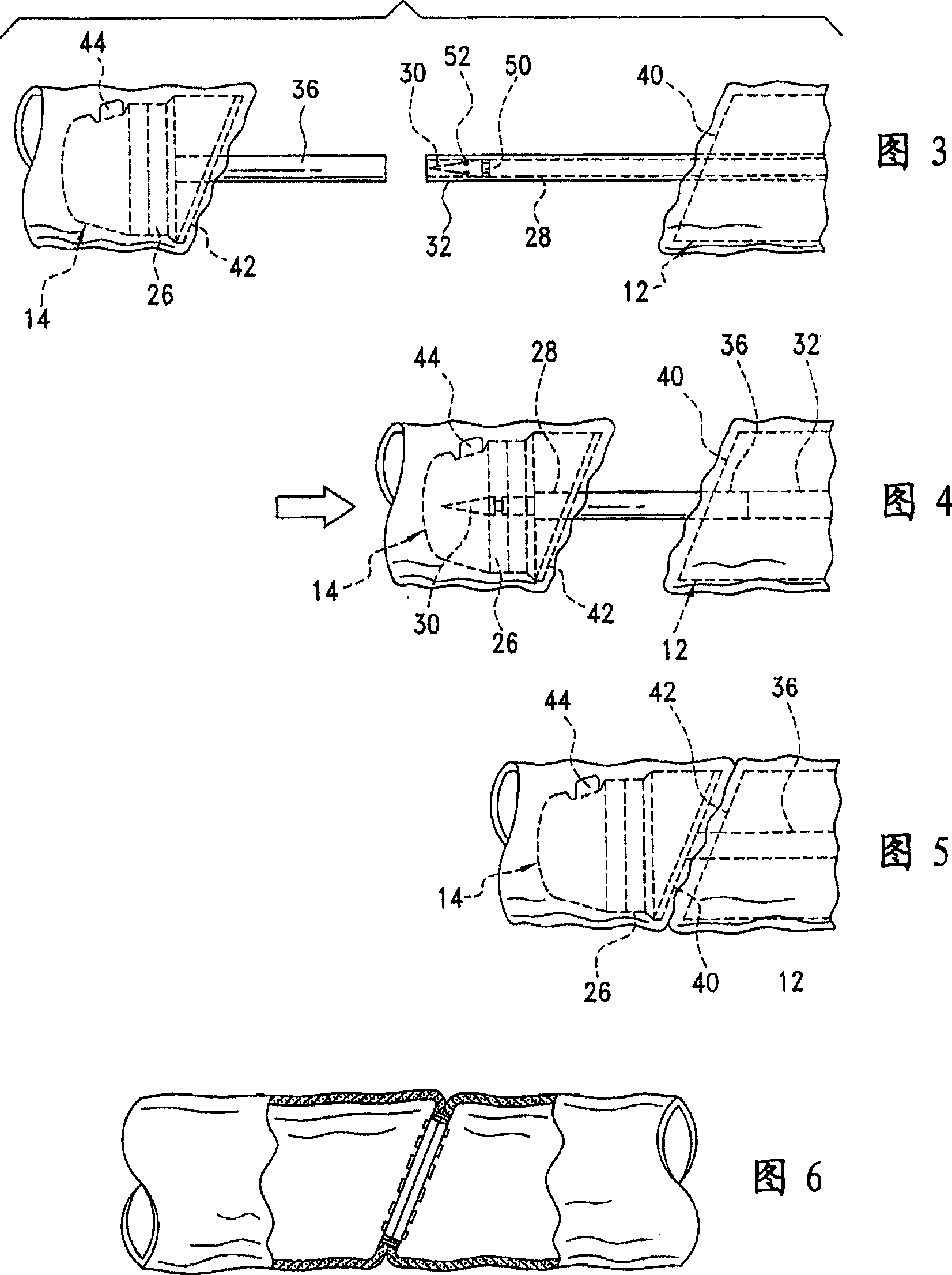 Elliptical intraluminal surgical stapler for anastomosis