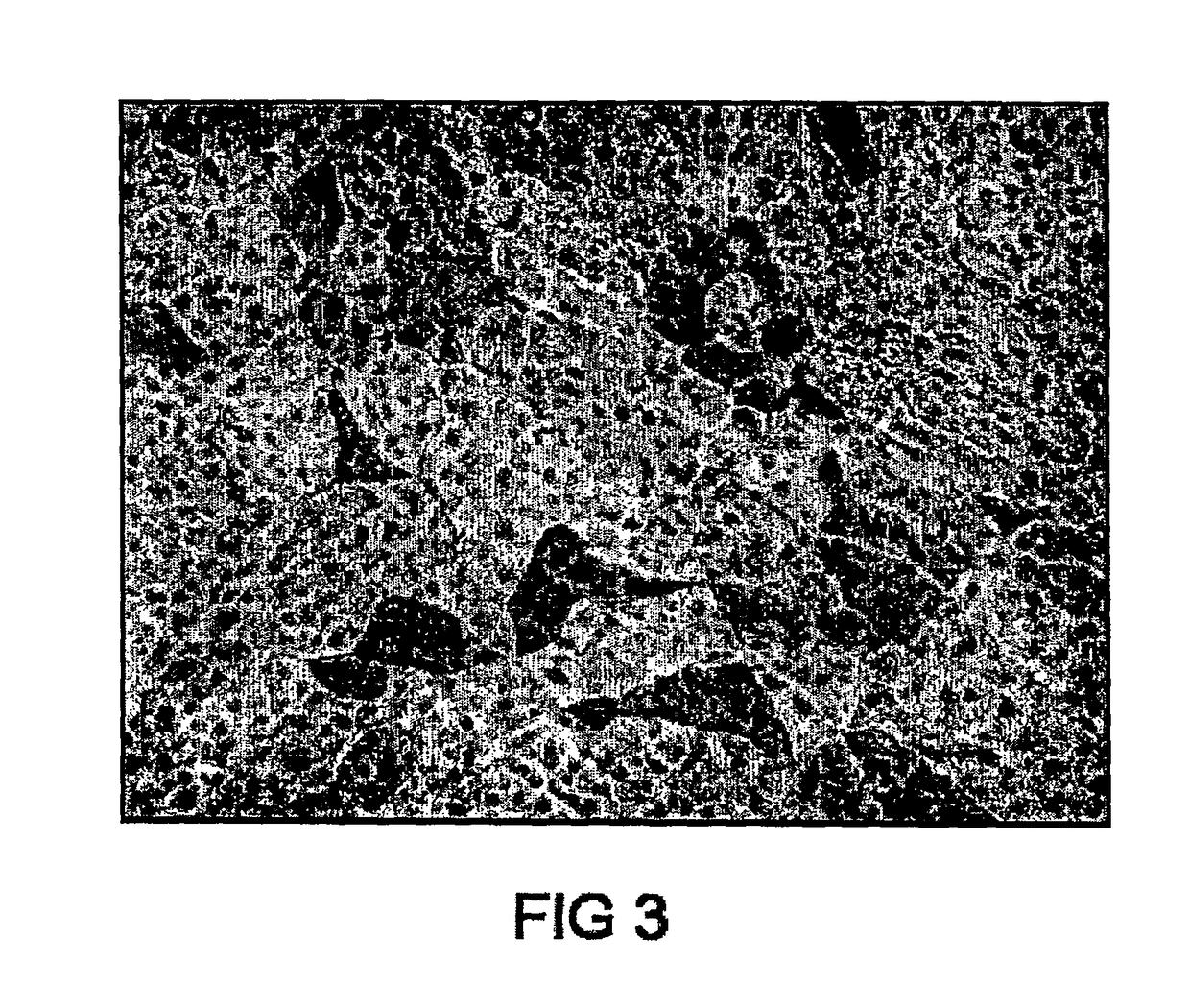 Cell marker for hepatic and pancreatic stem cells and progenitor cells