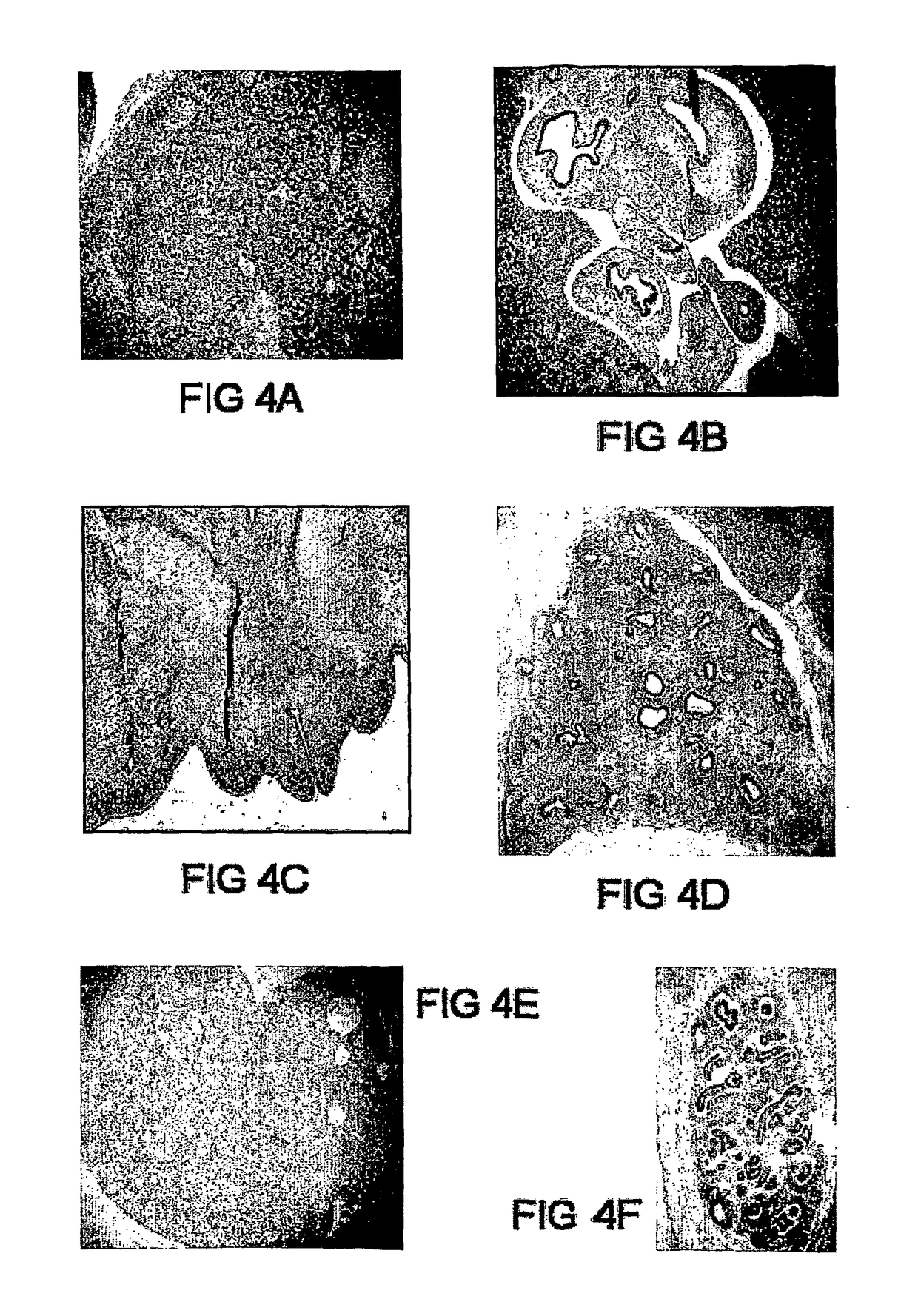 Cell marker for hepatic and pancreatic stem cells and progenitor cells