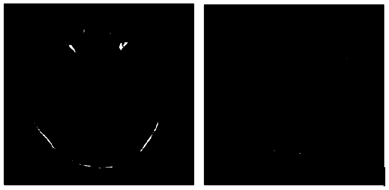 A multi-mode three-dimensional image registration and fusion display method