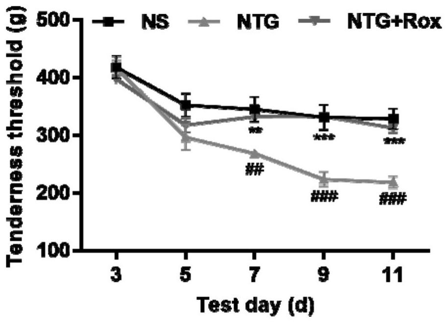 Application of roxadustat in medicine for treating migraine and medicine containing roxadustat