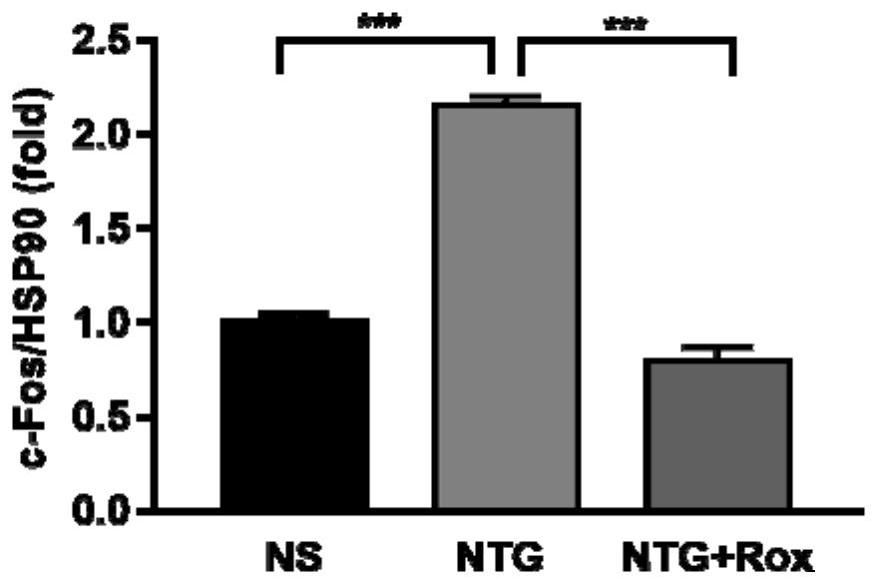 Application of roxadustat in medicine for treating migraine and medicine containing roxadustat