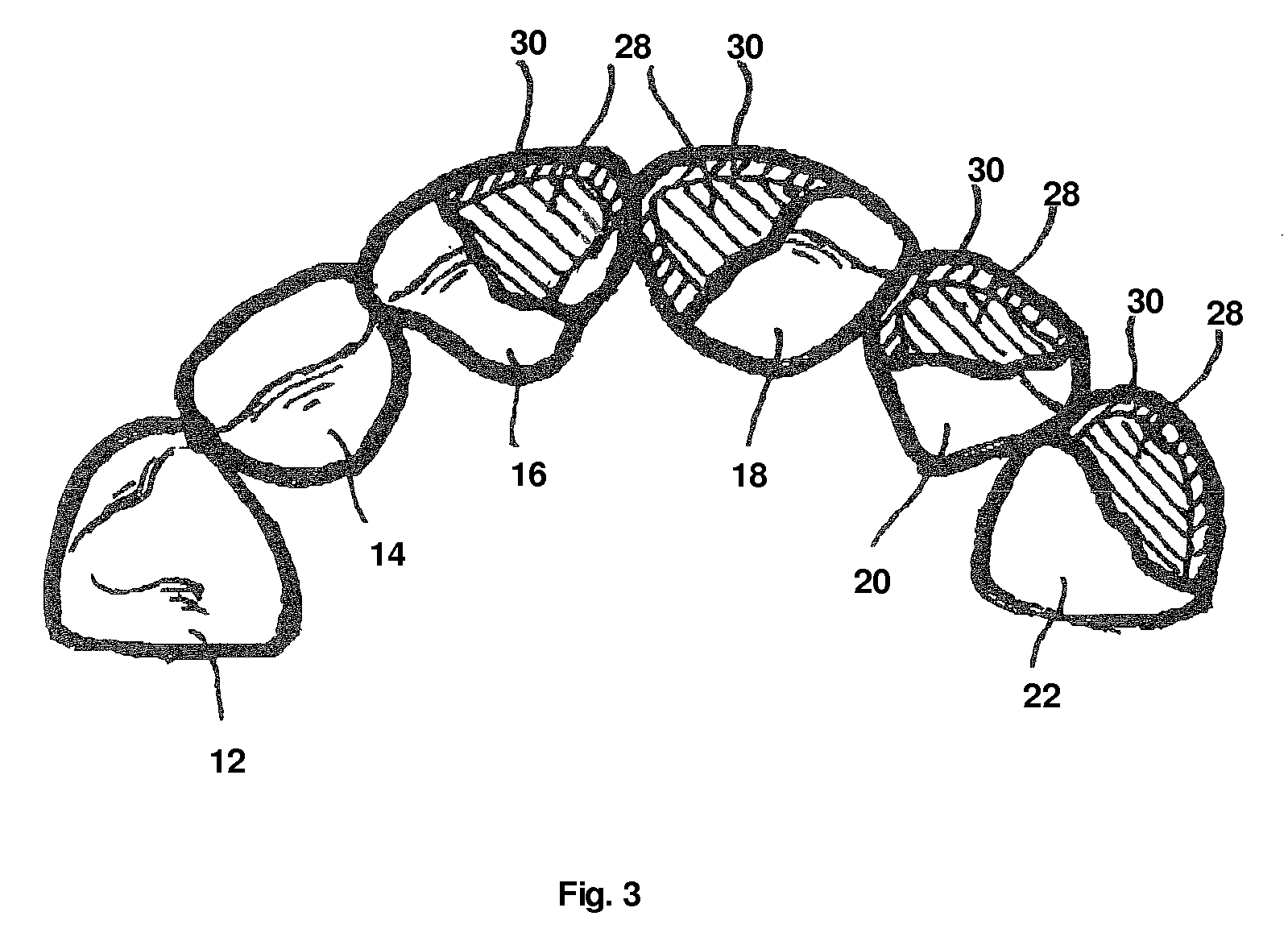 Incisor tooth or canine tooth, and set of teeth, and method for producing and incisor tooth or canine tooth