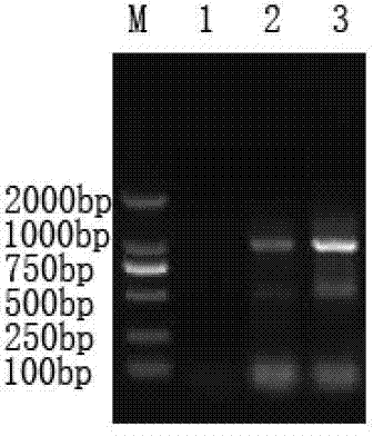 Method for cloning of pleurotus djamor HP1 laccase gene and dye decoloration of recombinase