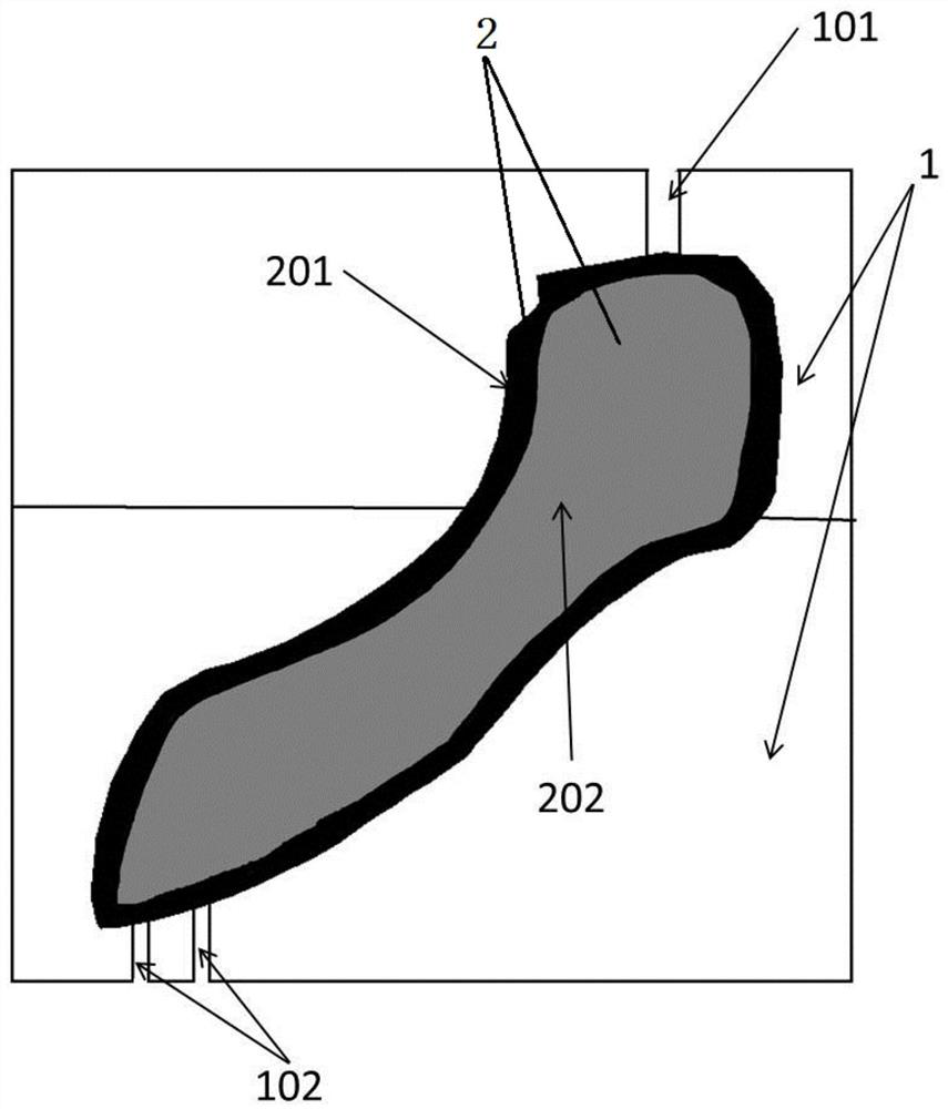 Mandibular implant and method of making same