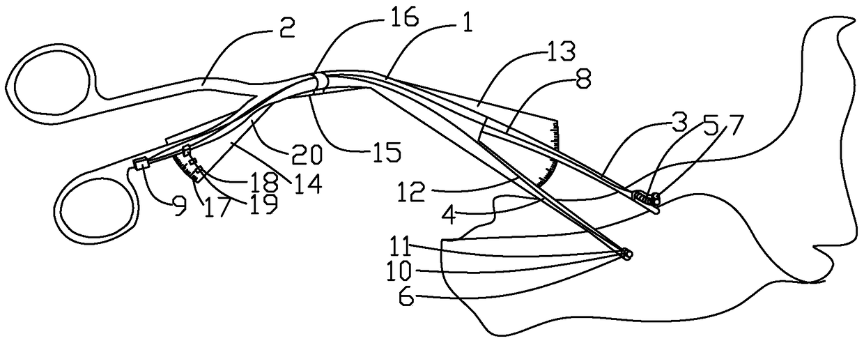 endotracheal tube forceps