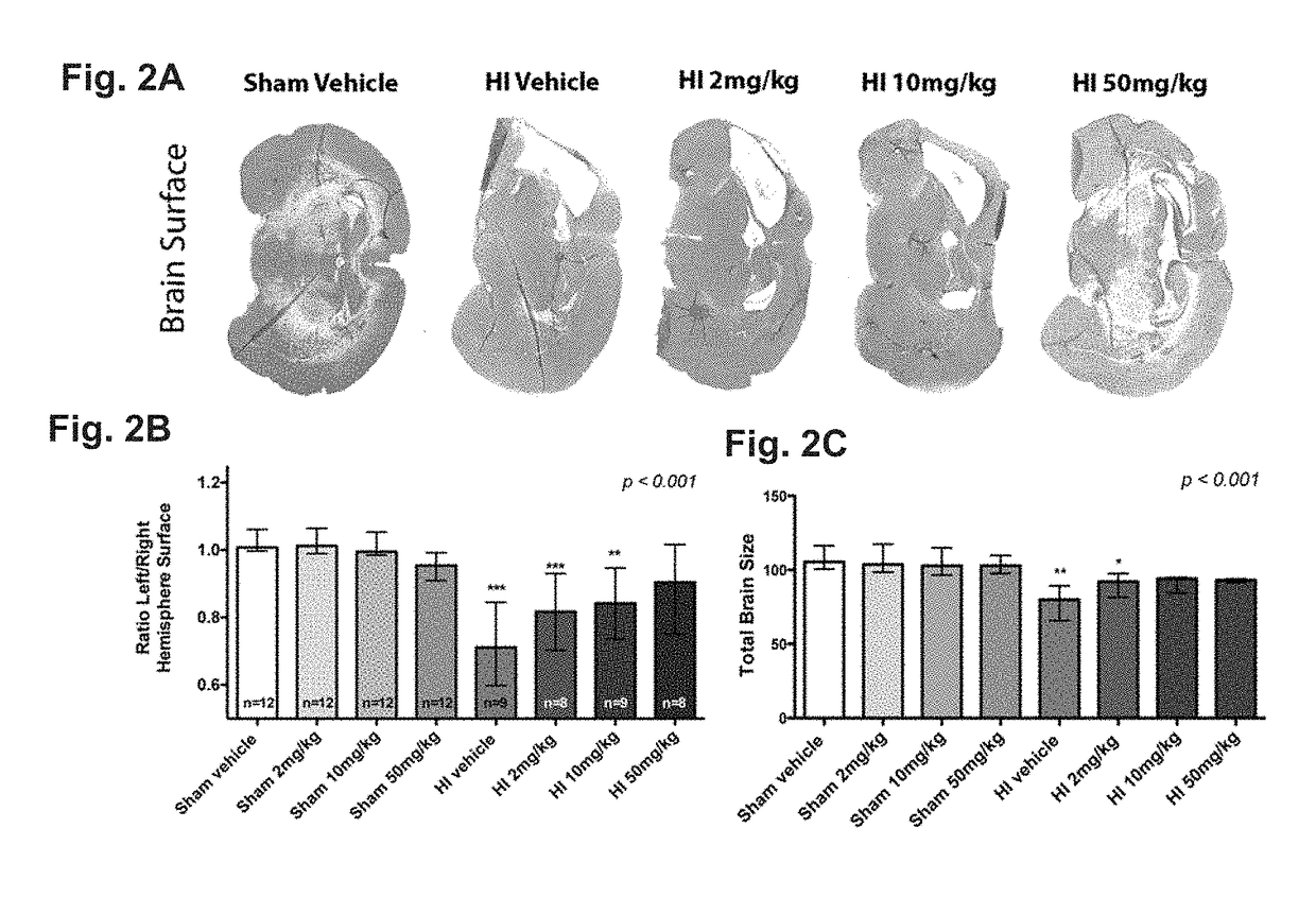 Phosphodiesterase inhibitors to repair brain and/or retinal injury in human newborns