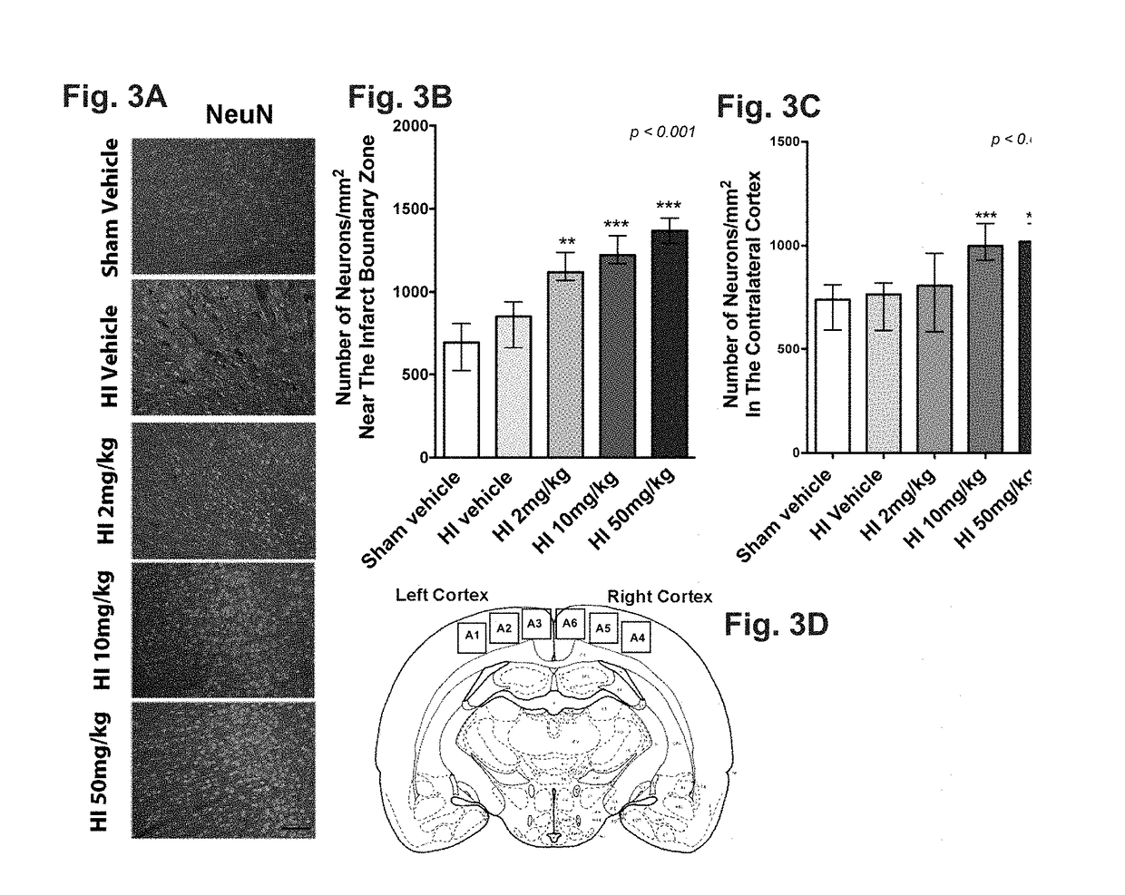 Phosphodiesterase inhibitors to repair brain and/or retinal injury in human newborns