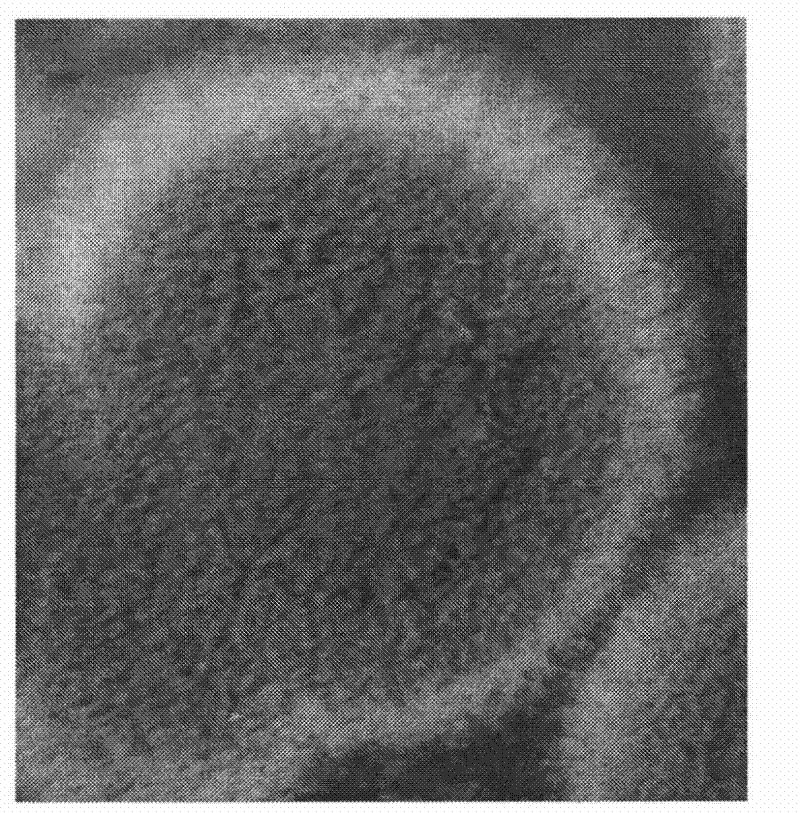 Method for preparing epipodophyllotoxin diglucoside and special bacterial strain thereof