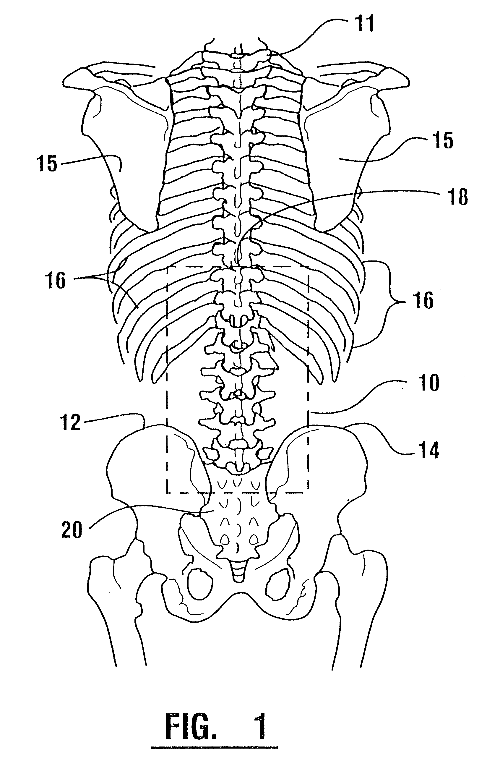 EMG electrode apparatus and positioning system