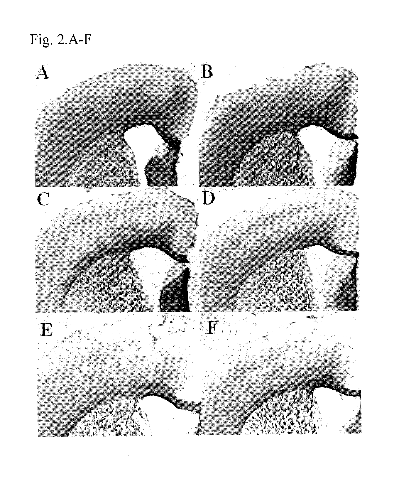 Method of treating demyelination diseases