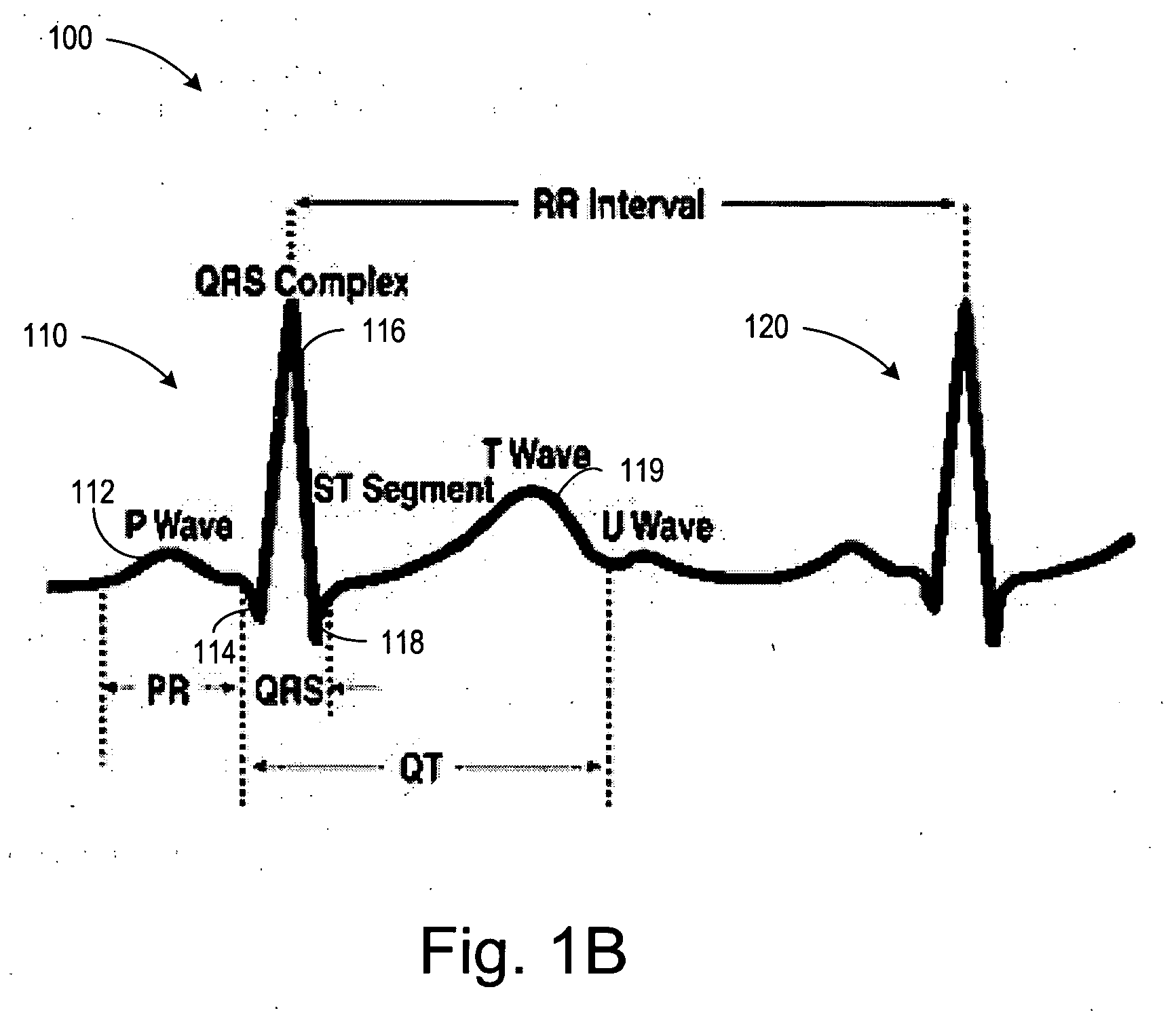 Implantable cardiac device and method for reduced phrenic nerve stimulation