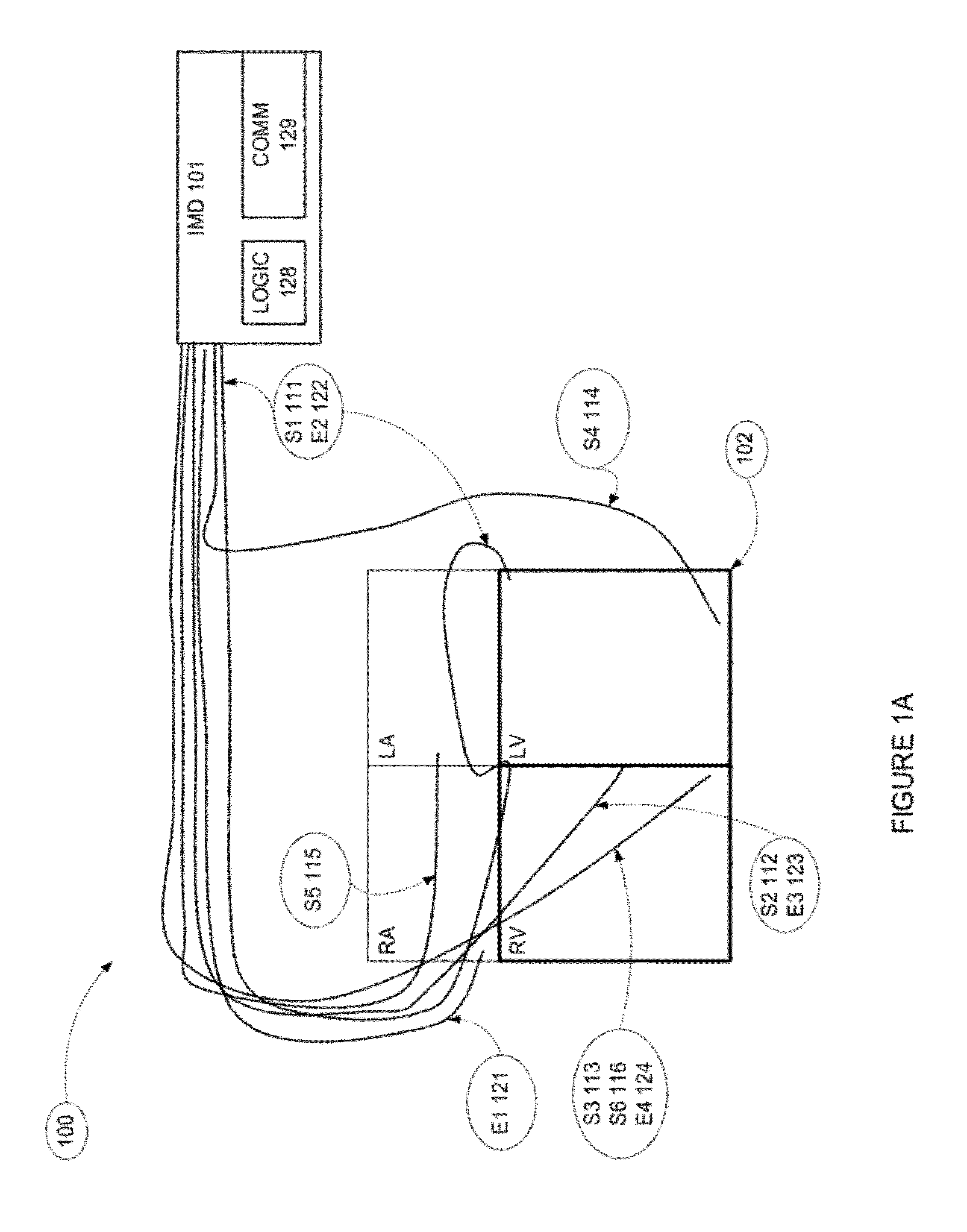 Methods and apparatus for optimizing cardiac output, preventing backward heart failure, and minimizing diastolic myocardial wall stress by controlling left ventricular filling