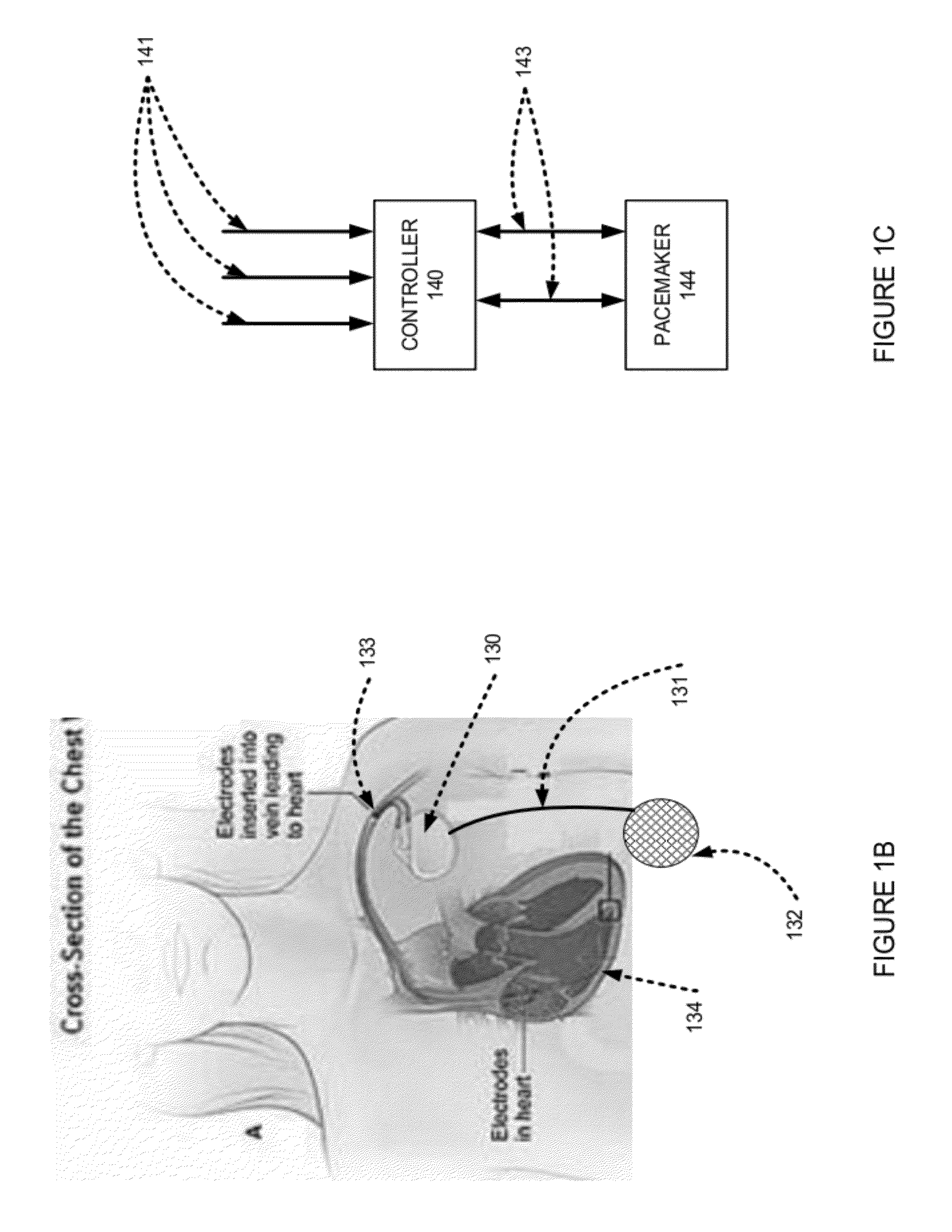 Methods and apparatus for optimizing cardiac output, preventing backward heart failure, and minimizing diastolic myocardial wall stress by controlling left ventricular filling