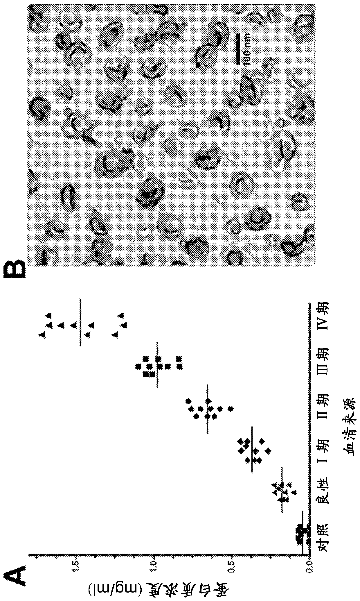 Exosome-associated microRNA as a diagnostic marker