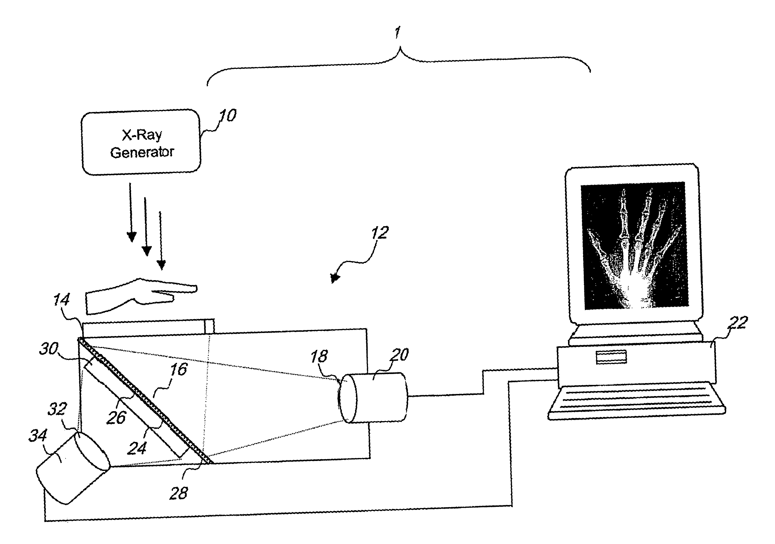 Dual energy imaging using optically coupled digital radiography system