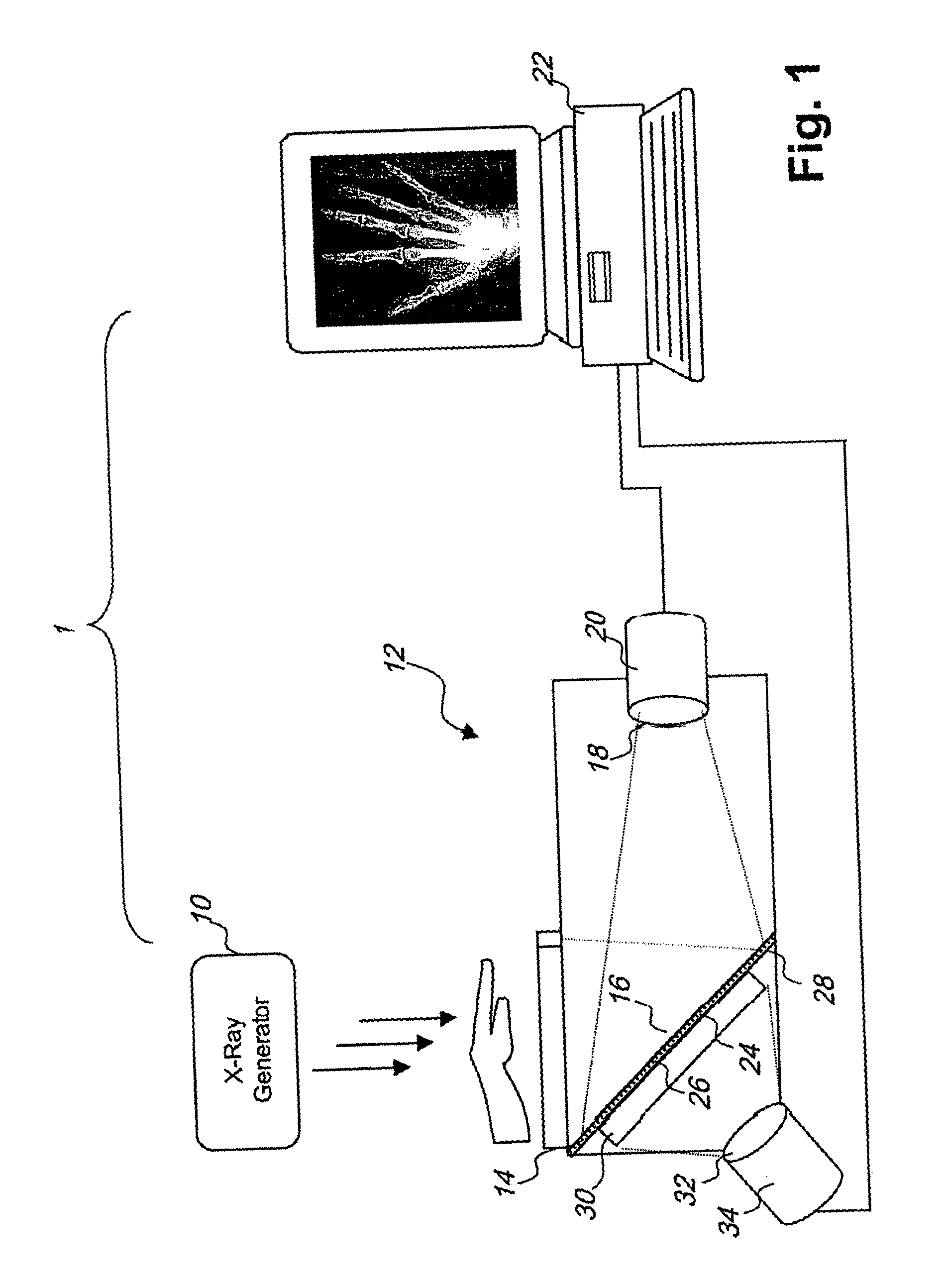 Dual energy imaging using optically coupled digital radiography system