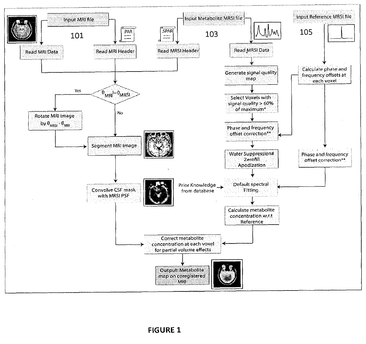 A method for metabolite signal quantitation for magnetic resonance spectroscopy data