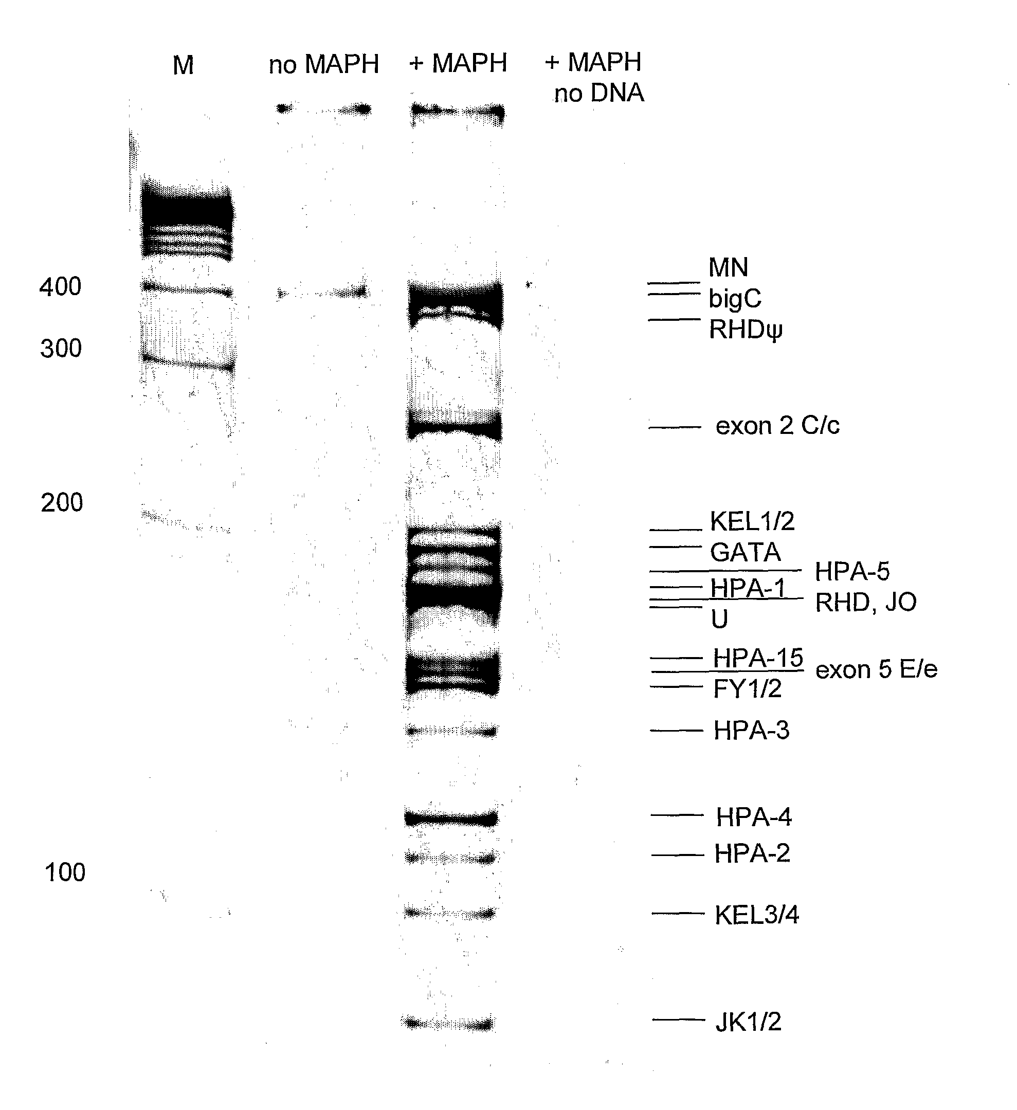 Method of Genotyping Blood Cell Antigens and Kit Suitable for Genotyping Blood Cell Antigens