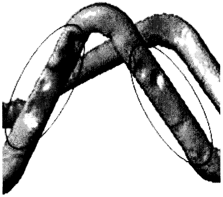 Coating structure of medical biodegradable zinc alloy stent and preparation method thereof