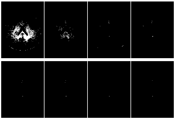 A Method to Eliminate the Even and Odd Phase Differences of MRI Gradient Echo Sequences