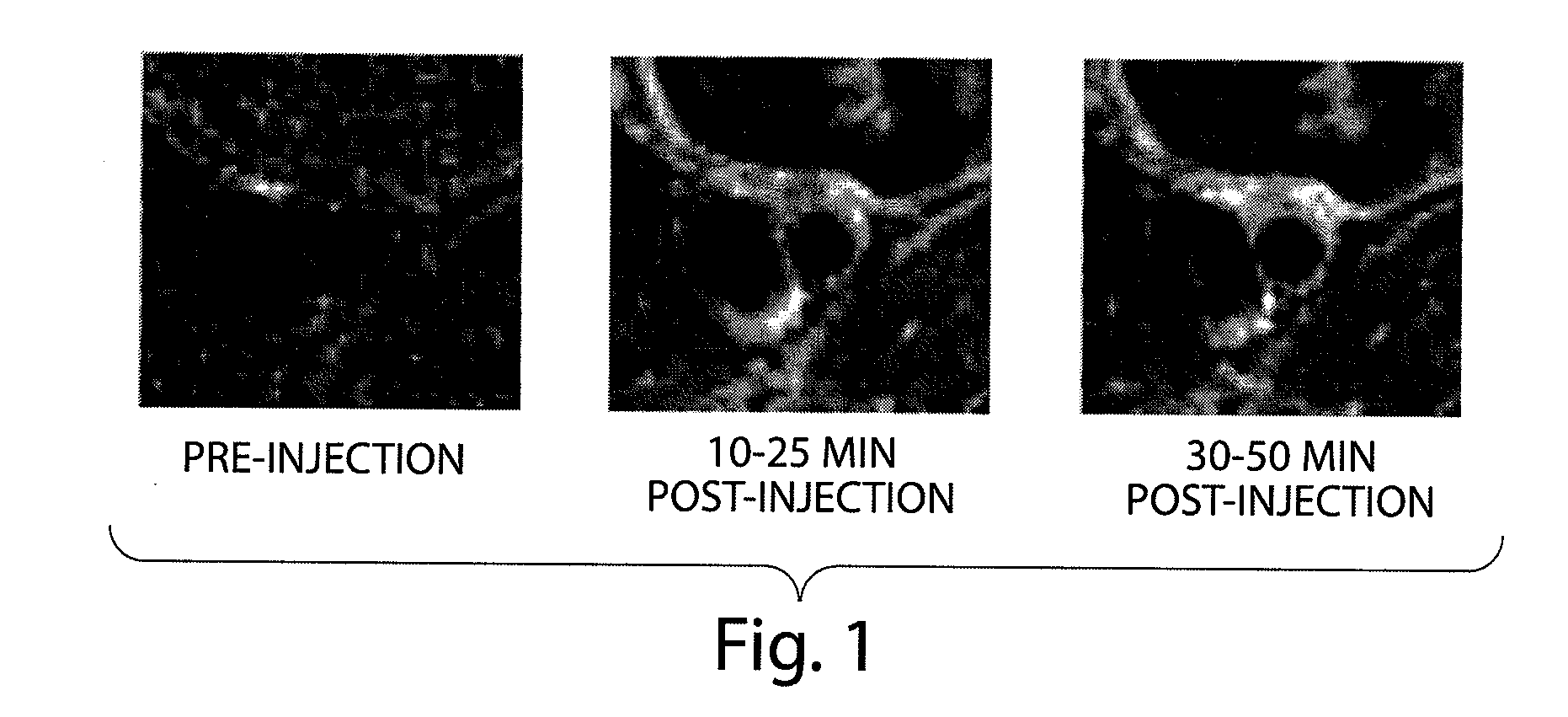 N-alkoxyamide conjugates as imaging agents