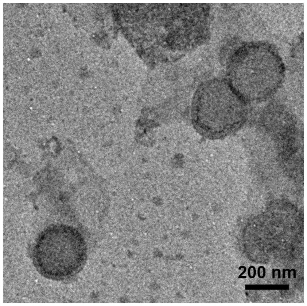 RNS-response-based 'nervous vascular unit' regulation and control targeted liposome drug delivery system and preparation method and application thereof