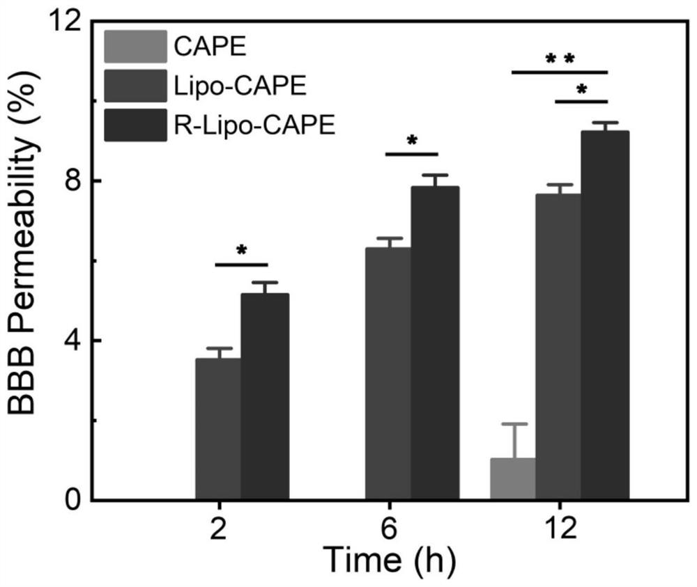 RNS-response-based 'nervous vascular unit' regulation and control targeted liposome drug delivery system and preparation method and application thereof